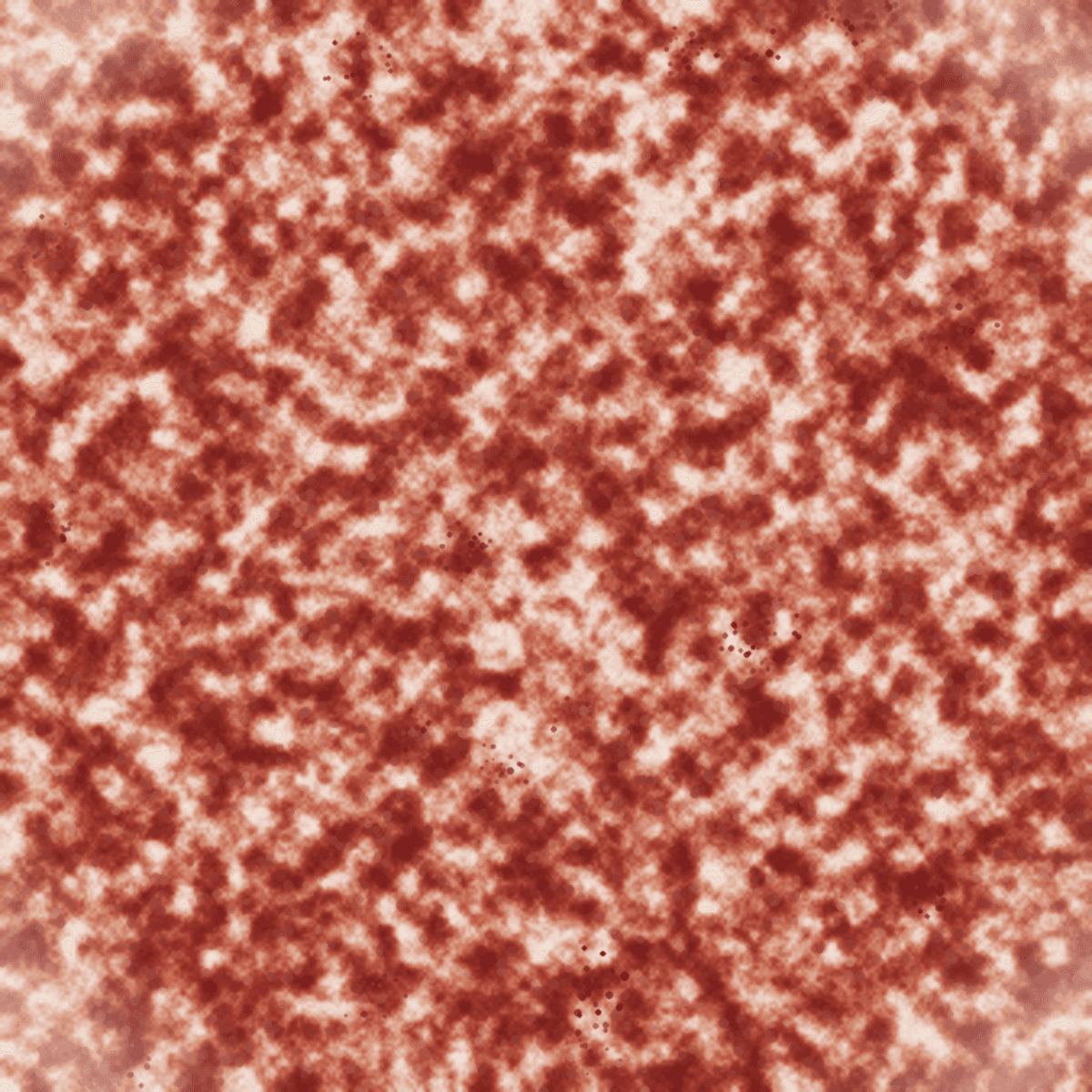 Psoriasis Triggers: What Causes Flare-Ups and How to Manage Them